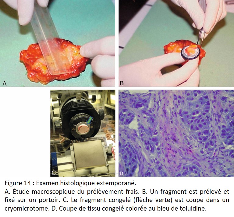 Histologie et pathologie des organes