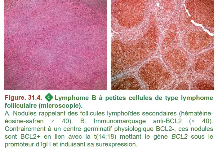 Soci t Fran aise De Pathologie IX H matologie
